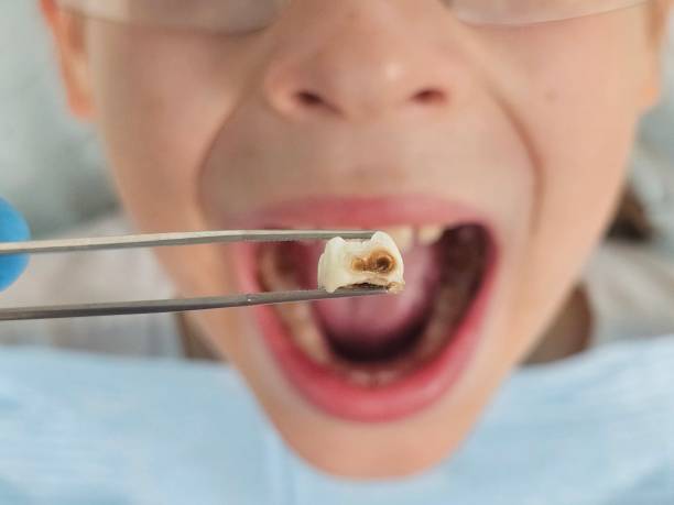 Best Emergency Dental Services for Seniors in Soquel, CA